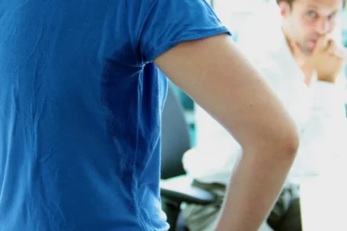 البوتكس لعلاج فرط التعرق